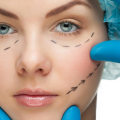 Why is plastic surgery stigmatized?