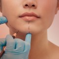 What are the top 3 plastic surgery procedures?