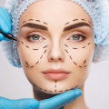 What's the disadvantages of plastic surgery?