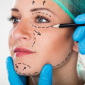 What is the correct term for plastic surgery?