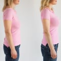 Breast Lift Before and After Photos: What You Need to Know