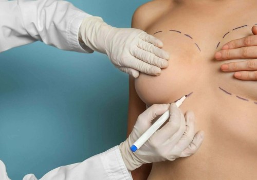 The Recovery Time for Breast Augmentation: What You Need to Know