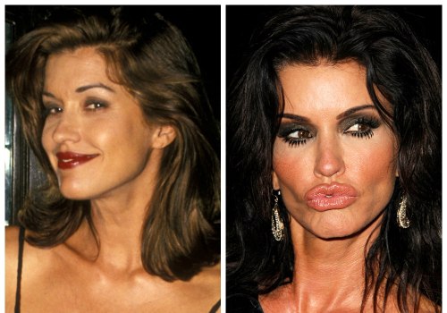 What are the results of bad plastic surgery?