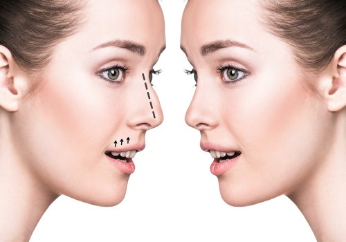 What is the best age for plastic surgery?