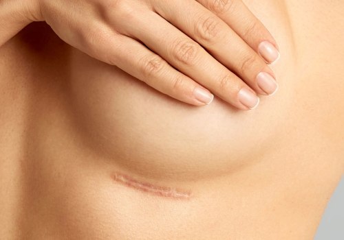 Surgical and Non-Surgical Scar Revision Options: A Comprehensive Guide