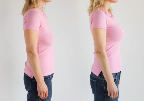 Breast Lift Before and After Photos: What You Need to Know